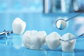 Dental bridge and implant with dental mirror on reflective blue surface