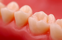 CLoseup of fillings