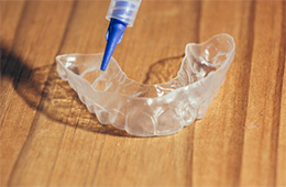 A customized whitening tray.